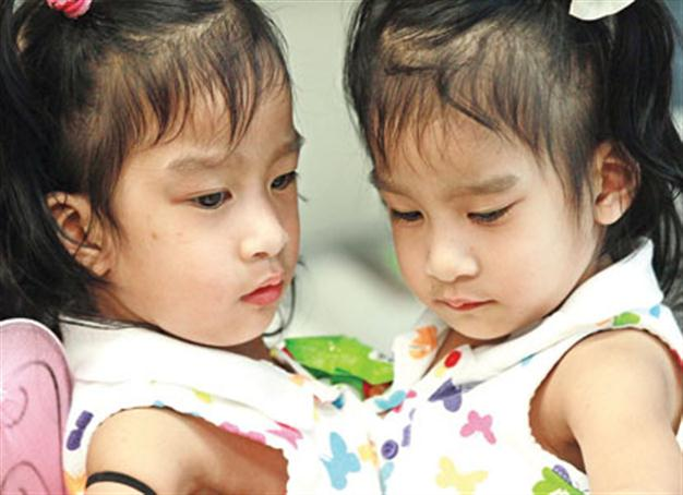 Twins of Philippines separated in the US