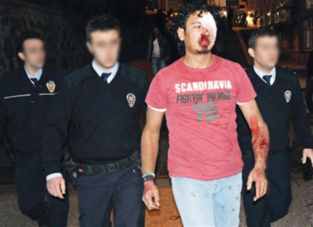Two Libyan veterans ‘beaten’ in Istanbul