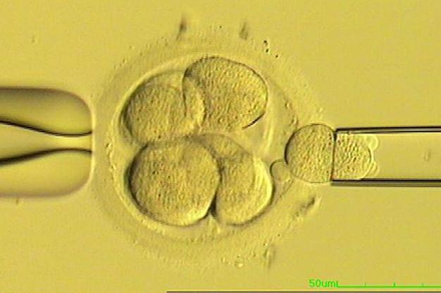 Fertility treatment may be a revolution