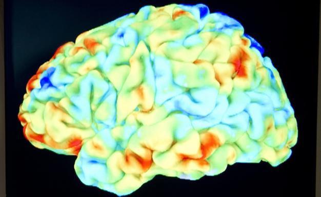 Mind-reading device tried on Stephen Hawking