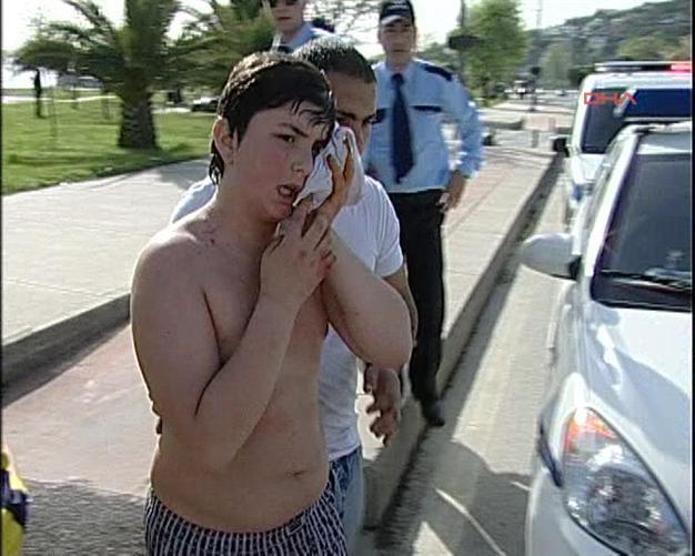 Turkish boy drowns pit bull after being attacked in Istanbul