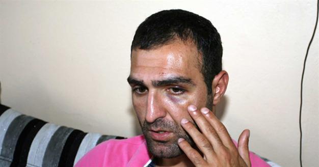 Lawsuit opened against man beaten by Turkish police