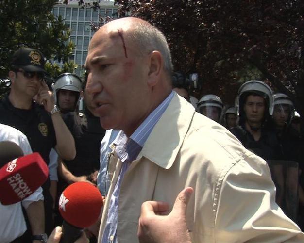 Opposition deputy wounded in clash with police during protest