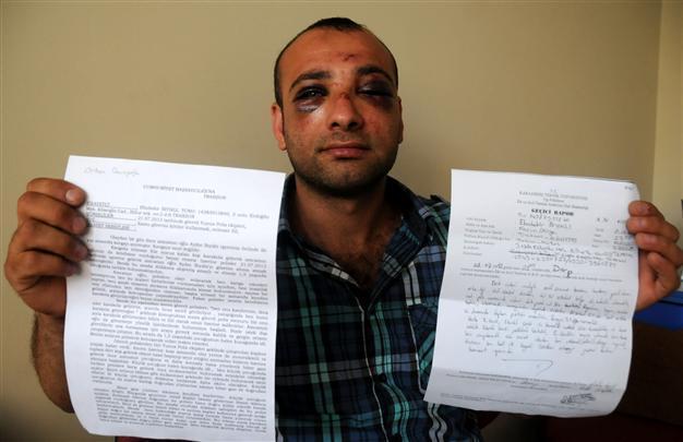 Turkish police allegedly gas man holding infant son