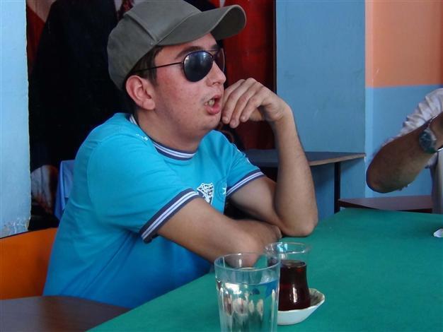 Fourth face-transplant patient learns to laugh