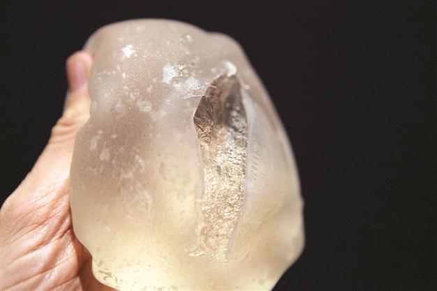 Hundreds of women expected for French breast implants mega-trial