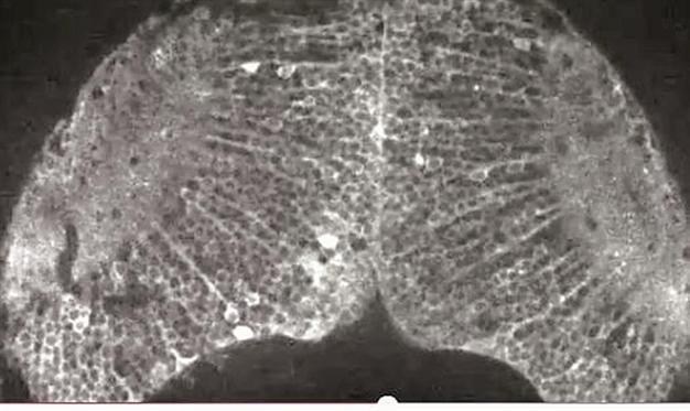 Brain scans show how pain is like