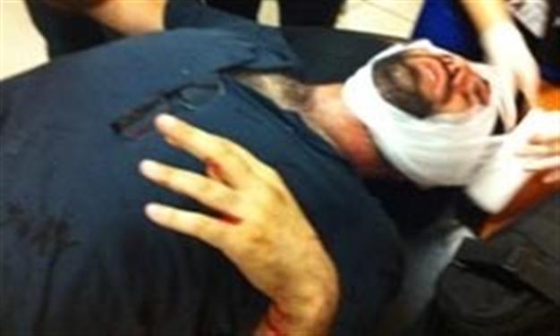 Veteran Hürriyet photojournalist injured by police taken to hospital