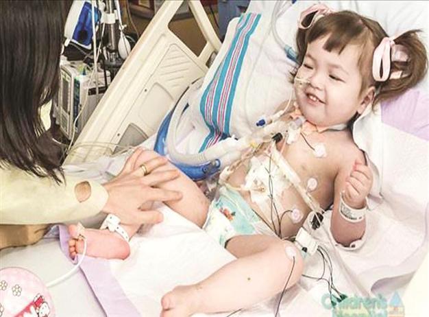 Trachea implant saves life of a toddler
