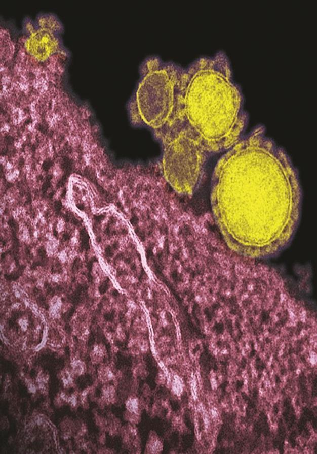 Deadly coronavirus serious risk in hospitals