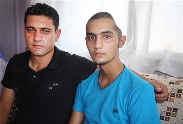 Gezi protester recovering from police tear gas attack after waking up from coma