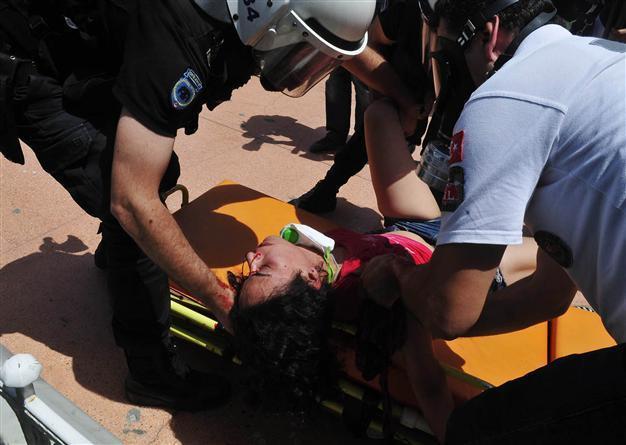 Gezi protester injured by police gas canister discharged from hospital after two brain surgeries