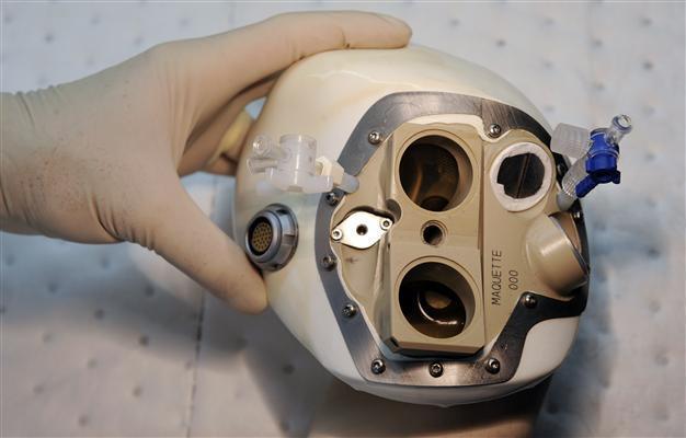 Patient doing well with French companys artificial heart: Report