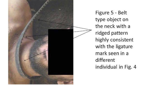 Syria says torture report politicised, photos fake