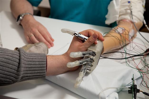 Bionic hand can now sense shape, texture