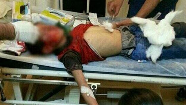 Another child injured during police intervention