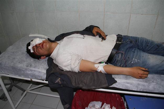 15-year-old blinded by a tear gas canister in southeastern Turkey during election protests