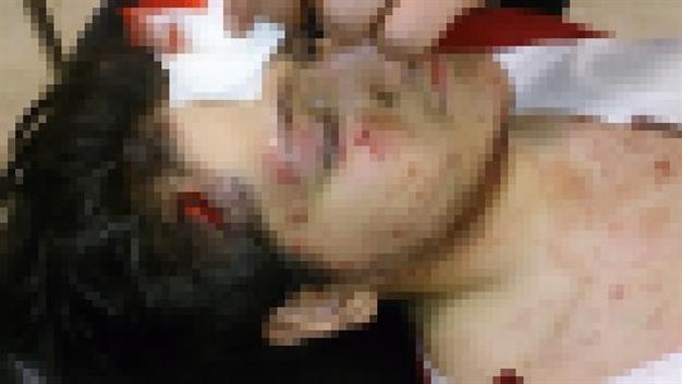 Footage showing student hit by police gas canister draws reactions