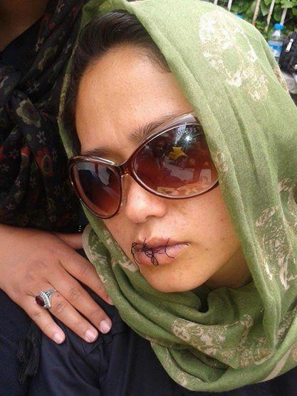 With mouths sewn shut, Afghan refugees keep protesting Ankara, UNHCR