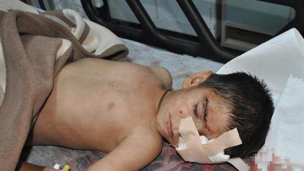 Six-year-old boy hit in eye by tear gas canister while ‘looking out of window’