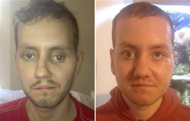 Build me a face in 3D: British mans life transformed