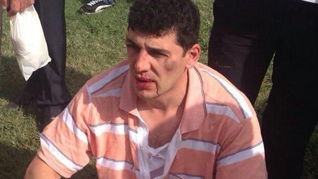 Main opposition MP takes Kuwaiti beating incident to Parliament