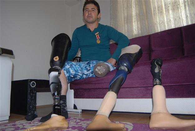Turkish veteran soldier faces repossession after failed payments for prosthetic leg