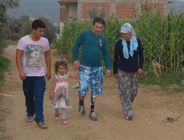 Turkey’s social security body to pay veteran in part for prosthetic leg after loan crisis