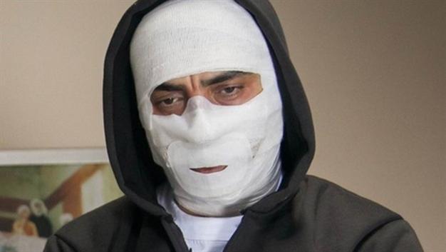 Turkish drama star discharged from hospital after breaking jaw