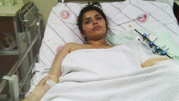 Pregnant by her mother’s killer, woman saves injured arm by aborting baby