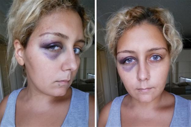 Turkish woman posts ex-boyfriend’s assaults on blog for help