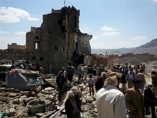 Yemen child prodigy badly burned in wedding bombing