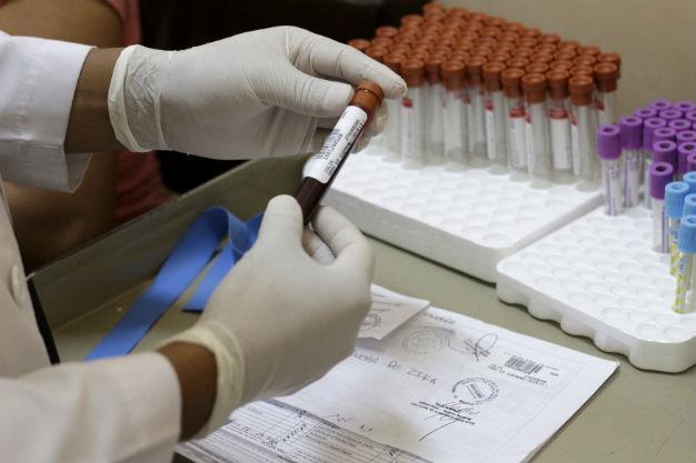 WHO calls for special meeting over Zika virus