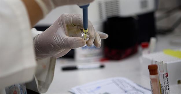 Brazil and University of Texas reach deal on Zika vaccine