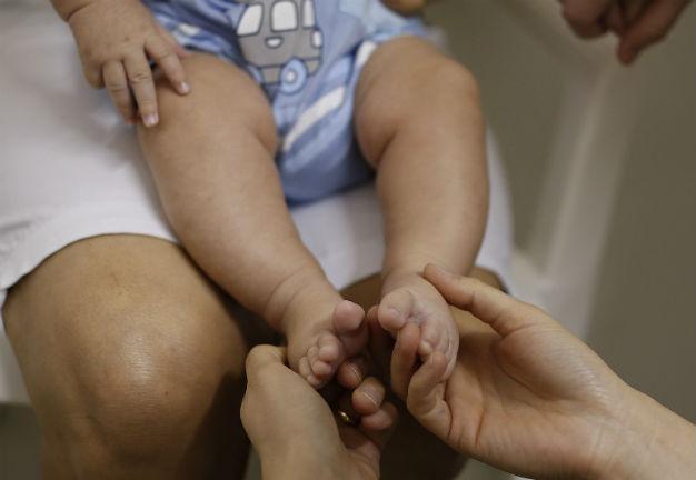 Zika can trigger severe neurological disorder, says study