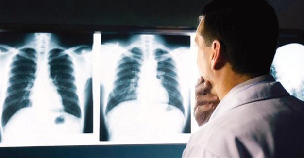 12 X-ray technicians at faculty hospital diagnosed with thyroid cancer in Turkey