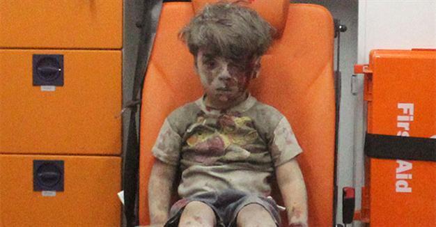 Brother of Omran, Syrian boy in haunting picture, dies of wounds
