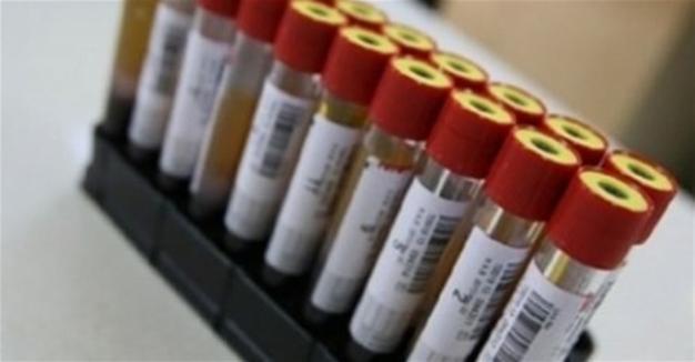 Turkish Stem Cell Bank makes first international transplant