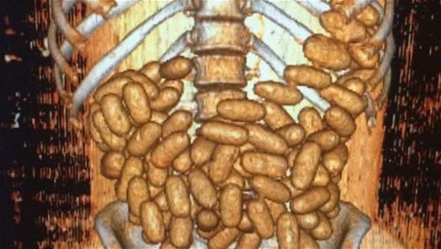 Istanbul police detain drug smugglers who swallowed 115 condoms
