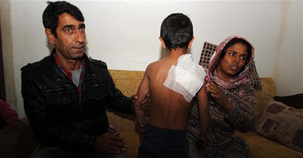 Fast food restaurant employee throws boiled water on seven-year-old boy in Istanbul