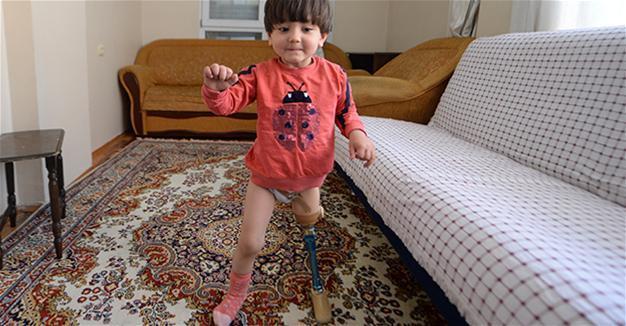 Turkish father teaching daughter with disabilities to walk with contraption due to lack of funds