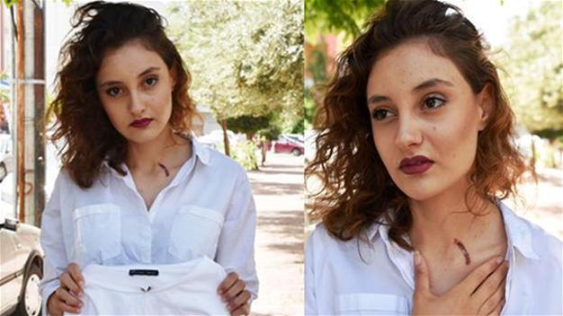 Antalya court orders arrest of man accused of burning woman with cigarette