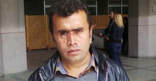 Court rules faulty for man who lost eye during Gezi protests in Ankara