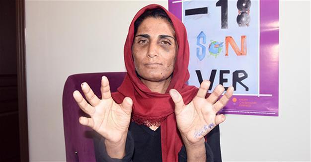 Turkish woman files criminal complaint against husband after 17 years of brutal torture