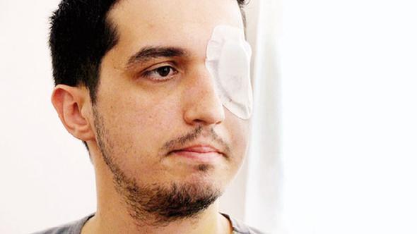 Court orders Interior Ministry to pay over 1 million liras to man who lost eye during Gezi protests
