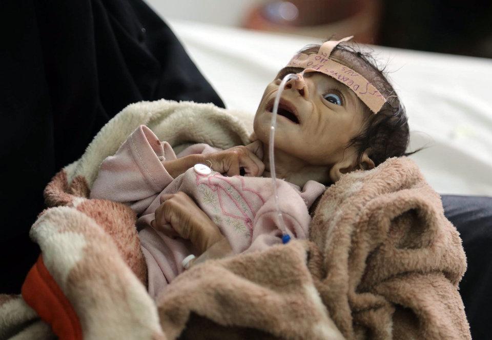 World Food Program fears more Yemen deaths amid blockade
