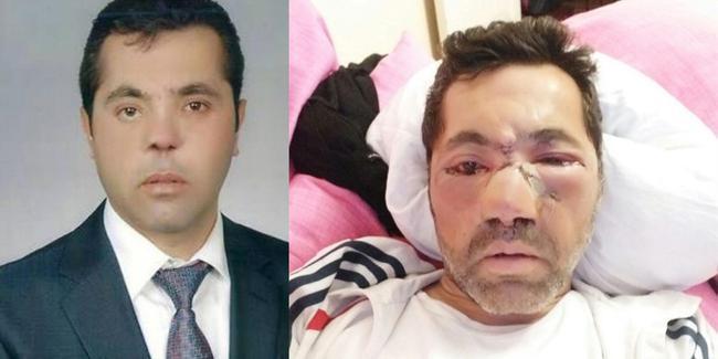 İzmir man receives 100,000 liras in compensation over infection in prison