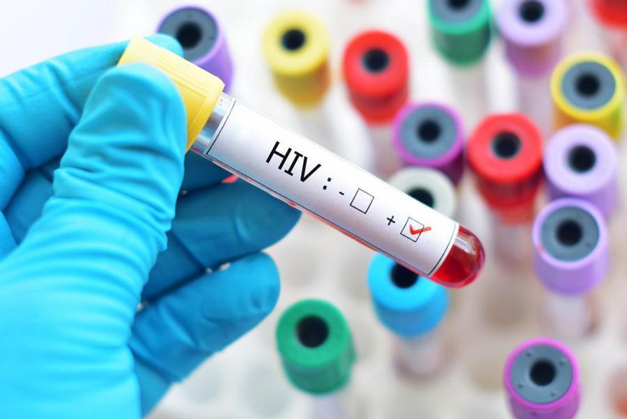 New research points to functional cure for HIV
