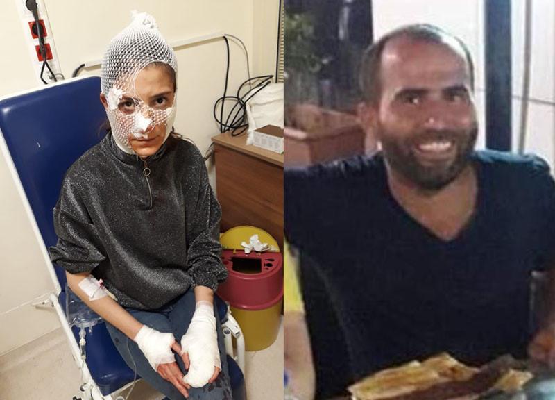 Man brutally attacks woman in street over refusal in Turkey’s south