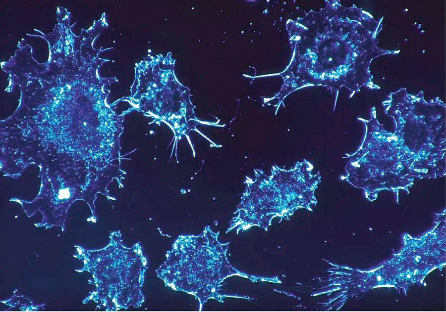 Israelis say they found cancer cure